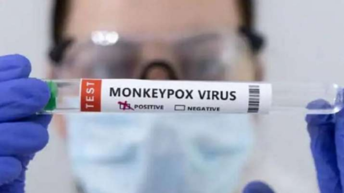 Monkeypox In Delhi